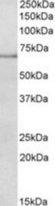 PAPD5 antibody (0.2 ug/ml) staining of Mouse Spleen lysate (35 ug protein/ml in RIPA buffer). Primary incubation was 1 hour. Detected by chemiluminescence.