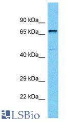 PAPD5 antibody Western Blot of MCF7. Antibody dilution: 1 ug/ml.