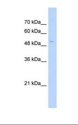 HepG2 cell lysate. Antibody concentration: 1.0 ug/ml. Gel concentration: 12%.