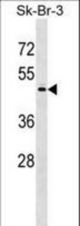 POLS Antibody western blot of SK-BR-3 cell line lysates (35 ug/lane). The POLS antibody detected the POLS protein (arrow).