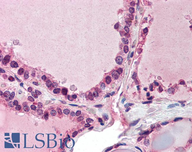 Anti-PAPD7 / POLS antibody IHC of human thyroid. Immunohistochemistry of formalin-fixed, paraffin-embedded tissue after heat-induced antigen retrieval. Antibody LS-B1981 concentration 5 ug/ml.