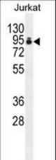 PAP Antibody western blot of Jurkat cell line lysates (35 ug/lane). The PAP antibody detected the PAP protein (arrow).