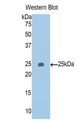 Western blot of recombinant PAPPA2 / Pappalysin 2.
