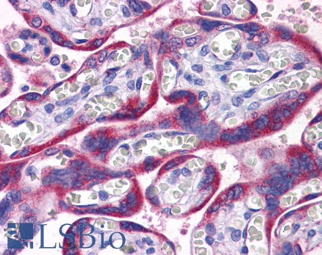 Anti-PAPPA2 antibody IHC of human placenta. Immunohistochemistry of formalin-fixed, paraffin-embedded tissue after heat-induced antigen retrieval. Antibody LS-B5346 concentration 5 ug/ml.