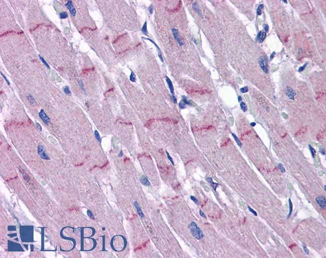 Anti-PAPPA2 antibody IHC of human heart. Immunohistochemistry of formalin-fixed, paraffin-embedded tissue after heat-induced antigen retrieval. Antibody LS-B5346 concentration 5 ug/ml.