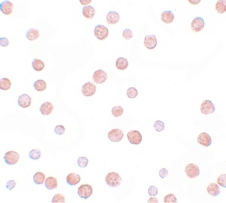 Immunocytochemistry of PLAC3 in HeLa cells with PLAC3 antibody at 10 ug/ml.