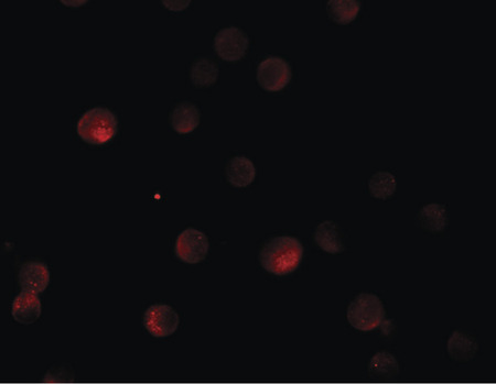 Immunofluorescence of PLAC3 in HeLa cells with PLAC3 antibody at 20 ug/ml.