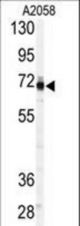 Western blot of anti-PAPSS1 Antibody (C-term A607) in A2058 cell line lysates (35 ug/lane). PAPSS1(arrow) was detected using the purified antibody.