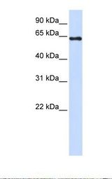 293T cell lysate. Antibody concentration: 1.0 ug/ml. Gel concentration: 12%.