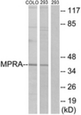 Western blot of extracts from 293/COLO cells, using MPRA Antibody. The lane on the right is treated with the synthesized peptide.