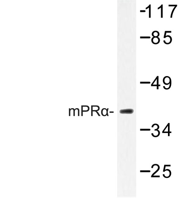 Western blot of mPR (K346) pAb in extracts from 293/COLO cells.