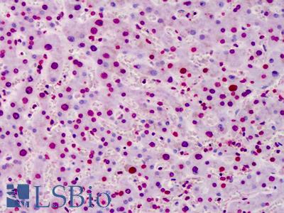 Anti-Poly ADP-Ribose antibody IHC of human liver. Immunohistochemistry of formalin-fixed, paraffin-embedded tissue after heat-induced antigen retrieval. Antibody LS-B4771 concentration 5 ug/ml.