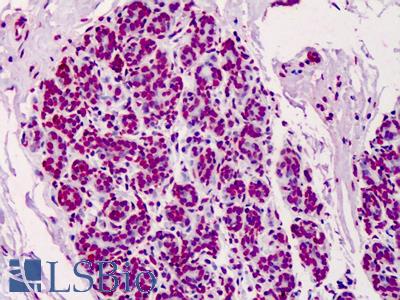 Anti-Poly ADP-Ribose antibody IHC of human breast. Immunohistochemistry of formalin-fixed, paraffin-embedded tissue after heat-induced antigen retrieval. Antibody LS-B4771 concentration 5 ug/ml.