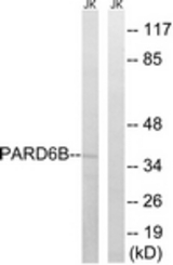 Western blot of extracts from Jurkat cells, using PARD6B Antibody. The lane on the right was incubated with synthetic peptide.