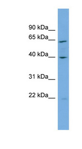 PARD6A / PAR6 antibody LS-C110723 Western blot of NCI-H226 cell lysate.