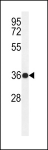 Western blot of PAR6G Antibody in ZR-75-1 cell line lysates (35 ug/lane). PAR6G (arrow) was detected using the purified antibody.