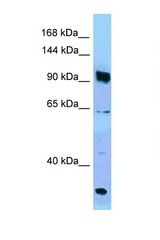 PARG antibody LS-C146321 Western blot of Jurkat Cell lysate. Antibody concentration 1 ug/ml.