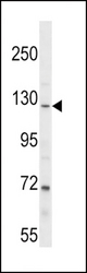 PARG Antibody western blot of NCI-H292 cell line lysates (35 ug/lane). The PARG antibody detected the PARG protein (arrow).