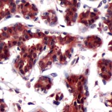 Human breast stained with Anti-DJ-1