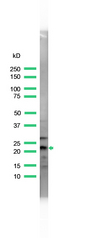 Western blot of PARK7 / DJ-1 antibody