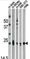 Western blot of anti-Park7 (DJ-1) Antibody in mouse brain,kidney,liver tissue lysates and NIH-3T3, HeLa cell line lysates (35 ug/lane). Park7 (arrow) was detected using the purified antibody.