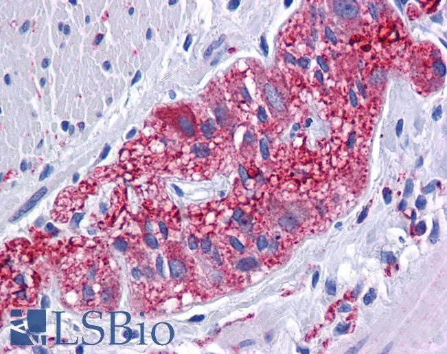 Anti-MFSD1 antibody IHC of human colon, myenteric plexus. Immunohistochemistry of formalin-fixed, paraffin-embedded tissue after heat-induced antigen retrieval. Antibody LS-B5347 concentration 5 ug/ml.