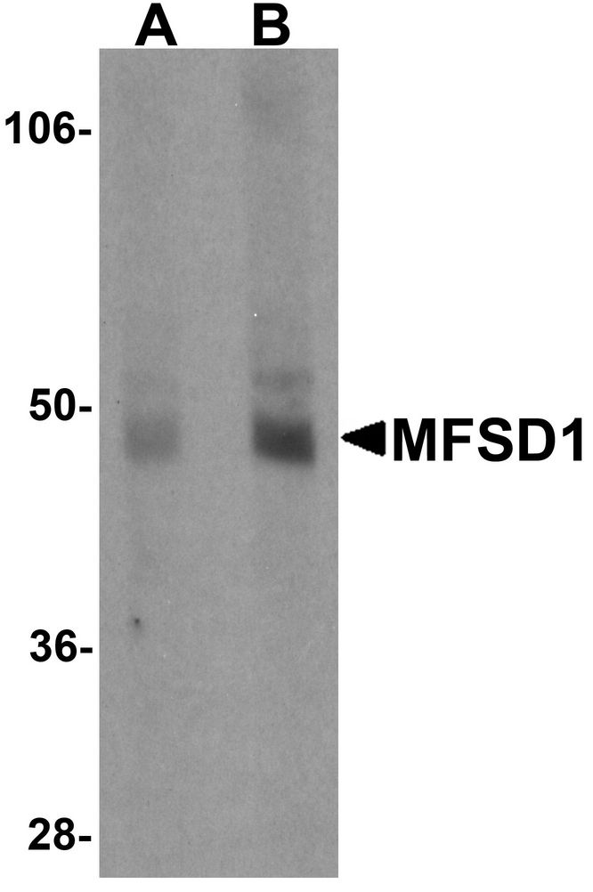 Western blot analysis of MFSD1 in human lung tissue lysate with MFSD1 antibody at (A) 1 and (B) 2 ug/ml.