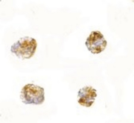 Immunocytochemistry of PARL in 3T3 cells with PARL antibody at 2.5 ug/ml.