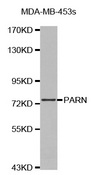 Western blot analysis of extracts of MDA-MB-453s cell lines, using PARN antibody.