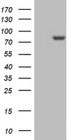 HEK293T cells were transfected with the pCMV6-ENTRY control (Left lane) or pCMV6-ENTRY PARN (Right lane) cDNA for 48 hrs and lysed. Equivalent amounts of cell lysates (5 ug per lane) were separated by SDS-PAGE and immunoblotted with anti-PARN.