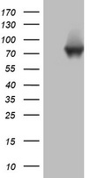 HEK293T cells were transfected with the pCMV6-ENTRY control (Left lane) or pCMV6-ENTRY PARN (Right lane) cDNA for 48 hrs and lysed. Equivalent amounts of cell lysates (5 ug per lane) were separated by SDS-PAGE and immunoblotted with anti-PARN.