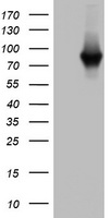 HEK293T cells were transfected with the pCMV6-ENTRY control (Left lane) or pCMV6-ENTRY PARN (Right lane) cDNA for 48 hrs and lysed. Equivalent amounts of cell lysates (5 ug per lane) were separated by SDS-PAGE and immunoblotted with anti-PARN.