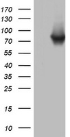 HEK293T cells were transfected with the pCMV6-ENTRY control (Left lane) or pCMV6-ENTRY PARN (Right lane) cDNA for 48 hrs and lysed. Equivalent amounts of cell lysates (5 ug per lane) were separated by SDS-PAGE and immunoblotted with anti-PARN.