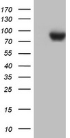 HEK293T cells were transfected with the pCMV6-ENTRY control (Left lane) or pCMV6-ENTRY PARN (Right lane) cDNA for 48 hrs and lysed. Equivalent amounts of cell lysates (5 ug per lane) were separated by SDS-PAGE and immunoblotted with anti-PARN.