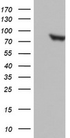 HEK293T cells were transfected with the pCMV6-ENTRY control (Left lane) or pCMV6-ENTRY PARN (Right lane) cDNA for 48 hrs and lysed. Equivalent amounts of cell lysates (5 ug per lane) were separated by SDS-PAGE and immunoblotted with anti-PARN.