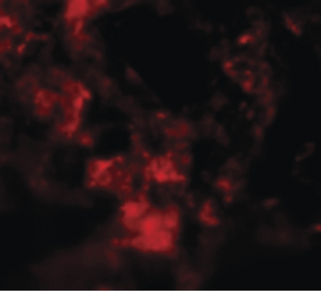 Immunofluorescence of MFSD2A in Rat Lung cells with MFSD2A antibody at 20 ug/ml.