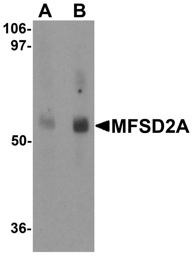 Western blot analysis of MFSD2A in rat lung tissue lysate with MFSD2A antibody at (A) 1 and (B) 2 ug/ml.