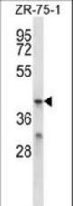 MFSD2B Antibody western blot of ZR-75-1 cell line lysates (35 ug/lane). The MFSD2B antibody detected the MFSD2B protein (arrow).