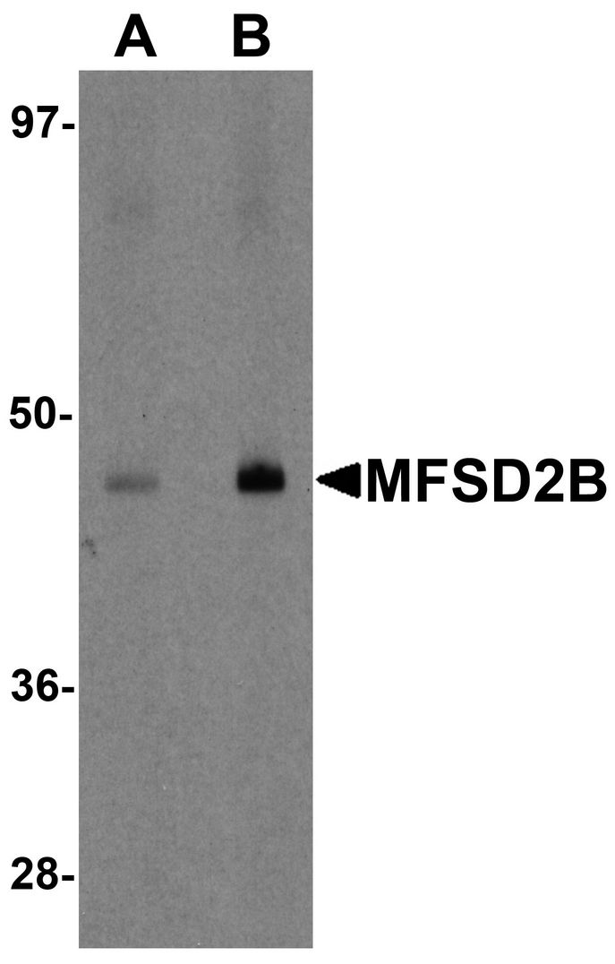 Western blot analysis of MFSD2B in rat lung tissue lysate with MFSD2B antibody at (A) 1 and (B) 2 ug/ml.