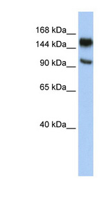 PARP10 antibody LS-C110722 Western blot of HepG2 cell lysate.