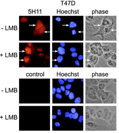 Immunofluorescence using anti-PARP-10 [ARTD10] (human), mAb (5H11). Method: T47D mammary carcinoma cells were stained by indirect immunofluorescence and analyzed. Prior to fixation and staining, the cells were treated with or without 50nm leptomycin B (LMB) as indicated for 2 h. Controls identify samples that were not incubated with the primary antibody (mAb 5H11) but only with the secondary antibody. The exposure times were identical for the stainings with and without primary antibody. DNA was identified by Hoechst stain. A phase contrast picture of the labeled cells is shown as well.