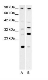 A. Fetal Muscle Lysate, B. Fetal Lung Lysate