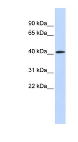 PARP11 antibody LS-C101463 Western blot of Fetal Muscle lysate.