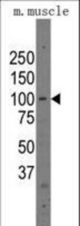 Western blot of anti-Parp12 antibody (RB14194) in mouse muscle tissue lysates (35 ug/lane). Parp12(arrow) was detected using the purified antibody.