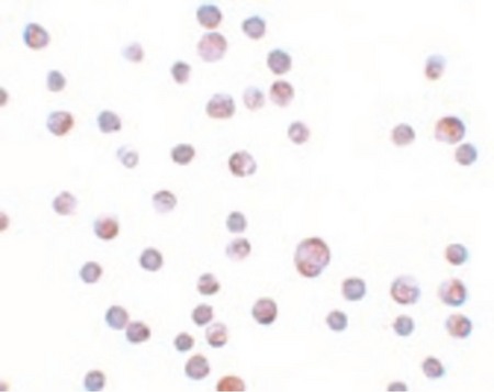 Immunocytochemistry of ZC3HAV1 in HeLa cells with ZC3HAV1 antibody at 20 ug/ml.