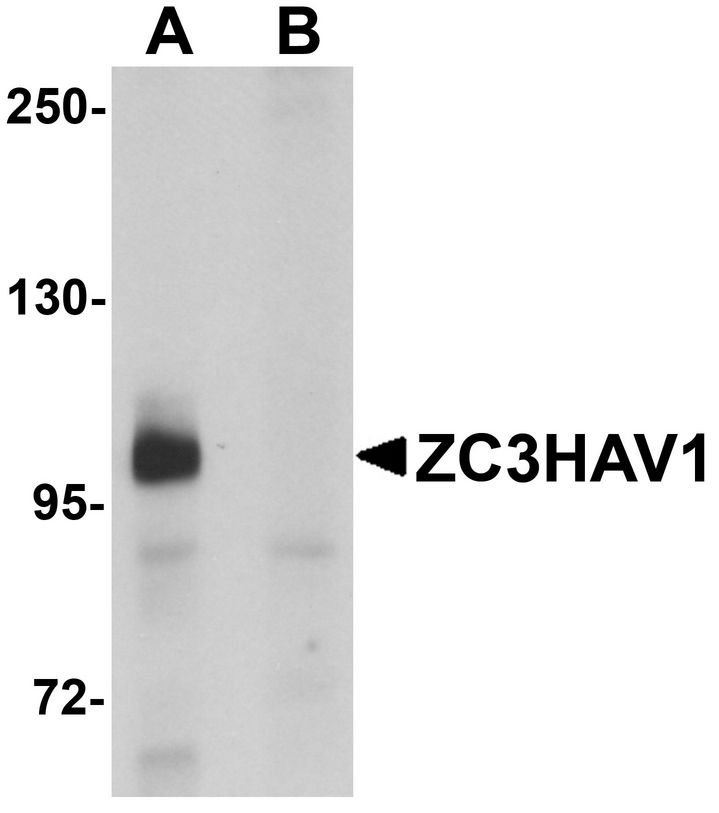 Western blot analysis of ZC3HAV1 in HeLa cell lysate with ZC3HAV1 antibody at 1ug/ml in (A) the absence and (B) the presence of blocking peptide.