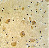 PARP16 Antibody IHC of formalin-fixed and paraffin-embedded human brain tissue followed by peroxidase-conjugated secondary antibody and DAB staining.