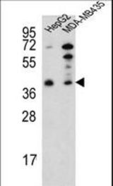 Western blot of PARP16 Antibody in HepG2,MDA-MB435 cell line lysates (35 ug/lane). PARP16 (arrow) was detected using the purified antibody.