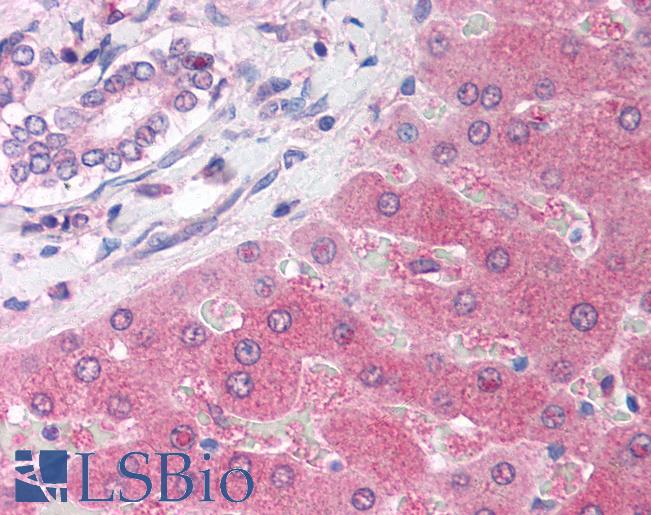 Anti-PARP2 antibody IHC of human liver. Immunohistochemistry of formalin-fixed, paraffin-embedded tissue after heat-induced antigen retrieval. Antibody LS-B1553 concentration 5 ug/ml.