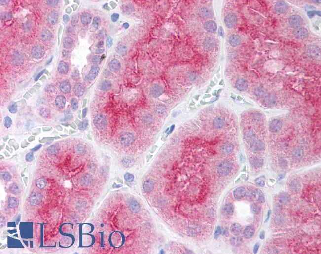 Anti-PARP2 antibody IHC of human kidney. Immunohistochemistry of formalin-fixed, paraffin-embedded tissue after heat-induced antigen retrieval. Antibody LS-B1553 concentration 5 ug/ml.